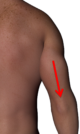 Tricep