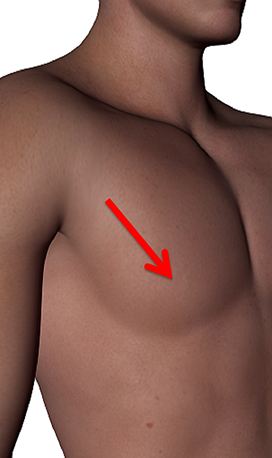 Chest