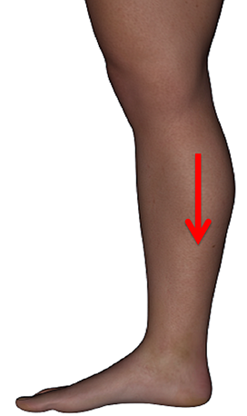 Calf