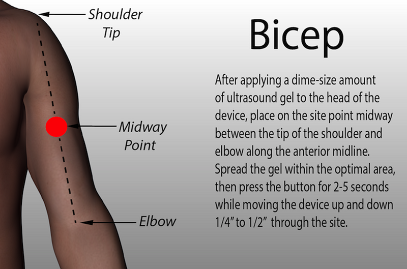 Bicep