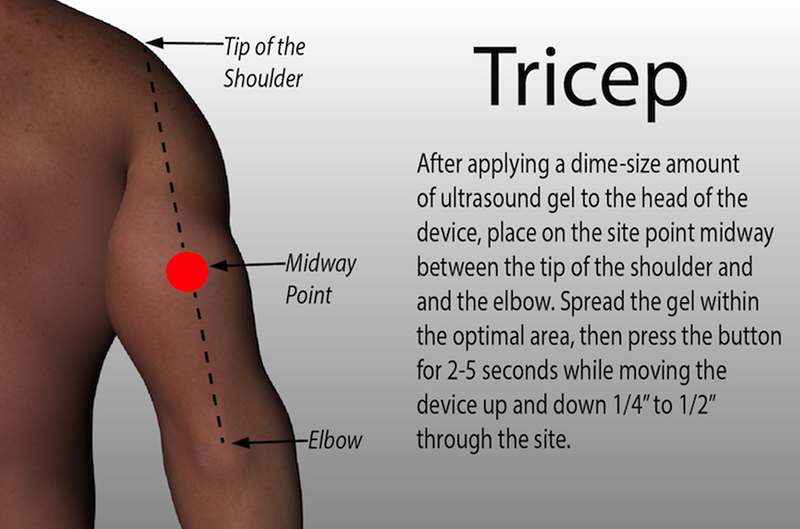 Tricep