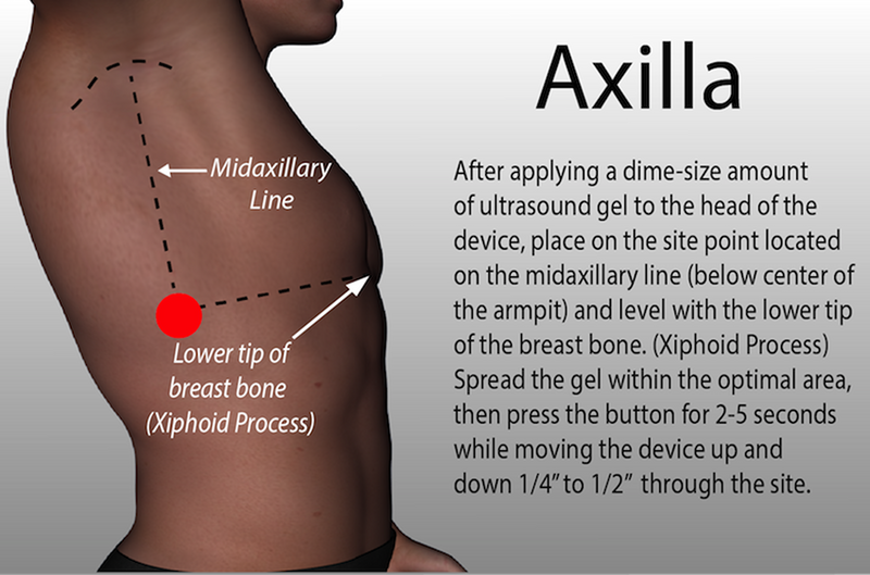 Axilla